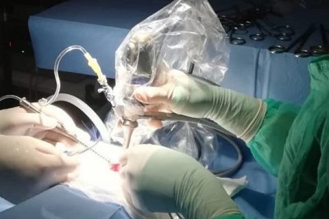 Chirurginės operacijos